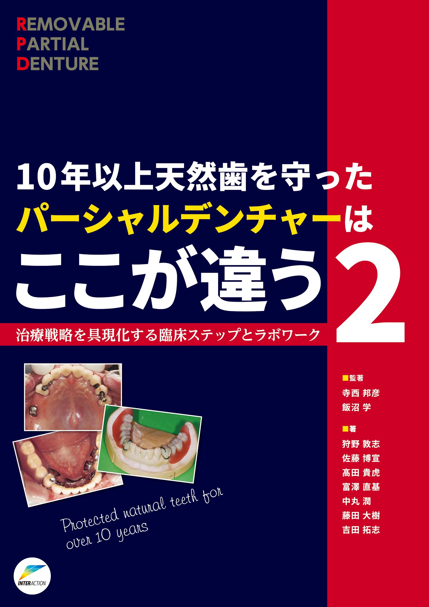 著書「10年以上天然歯を守ったパーシャルデンチャーはここが違う2」